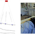 Listening to the Body at a Distance - RFID, Breathing, and the Quiet Transformation of Respiratory Medicine