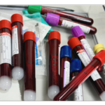 Swden's and Karolinska’s less-invasive diagnostics push: promise or hype?
