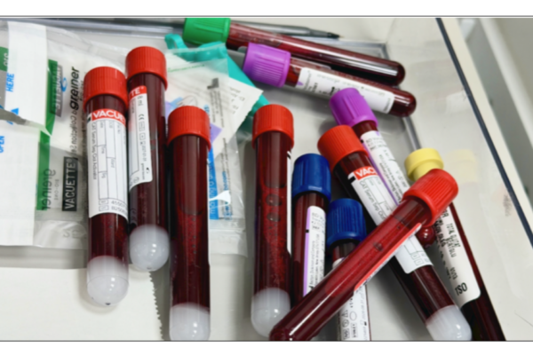 Swden’s and Karolinska’s less-invasive diagnostics push: promise or hype?